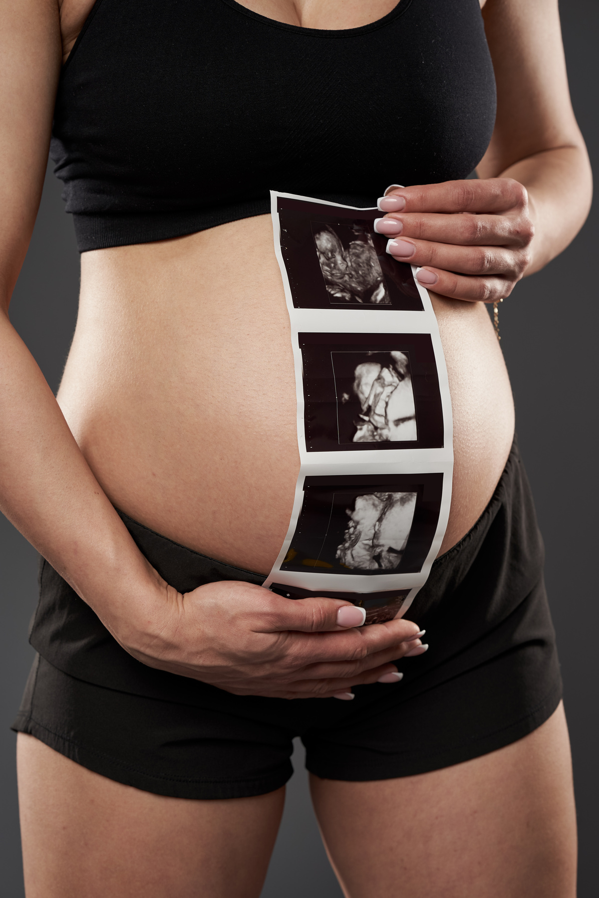 Pregnant lady showing morphology scan